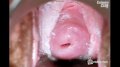 ການກວດ gynecological ຂອງແມ່ຍິງງາມ